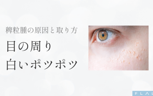 OR_MV_稗粒腫_251206