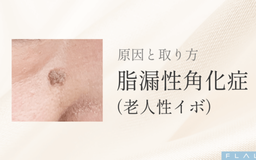 OR_MV_脂漏性角化症_251206