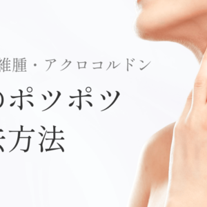 OR_MV_首のアクロコルドン_251206